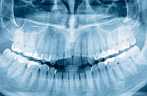 dentalutrera-clinicadental-cirugia