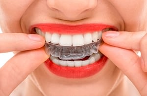 dentalutrera-clinicadental-ortodoncia