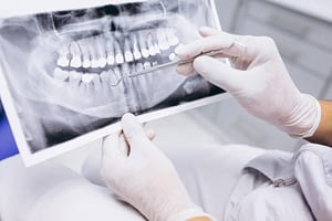 Tac dental radiografia