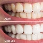 BLANQUEAMIENTO