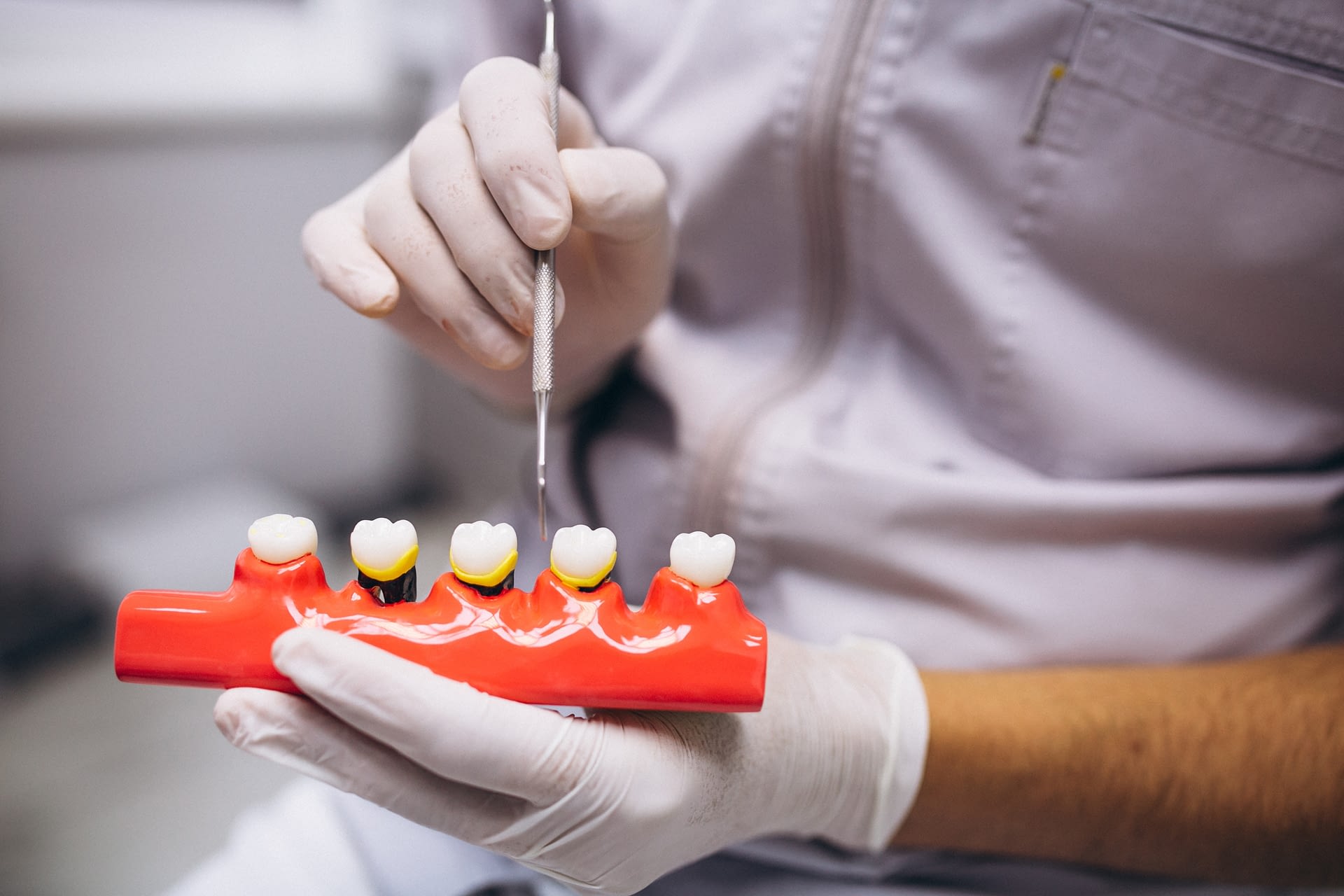 ¿La pérdida de dientes es hereditaria?